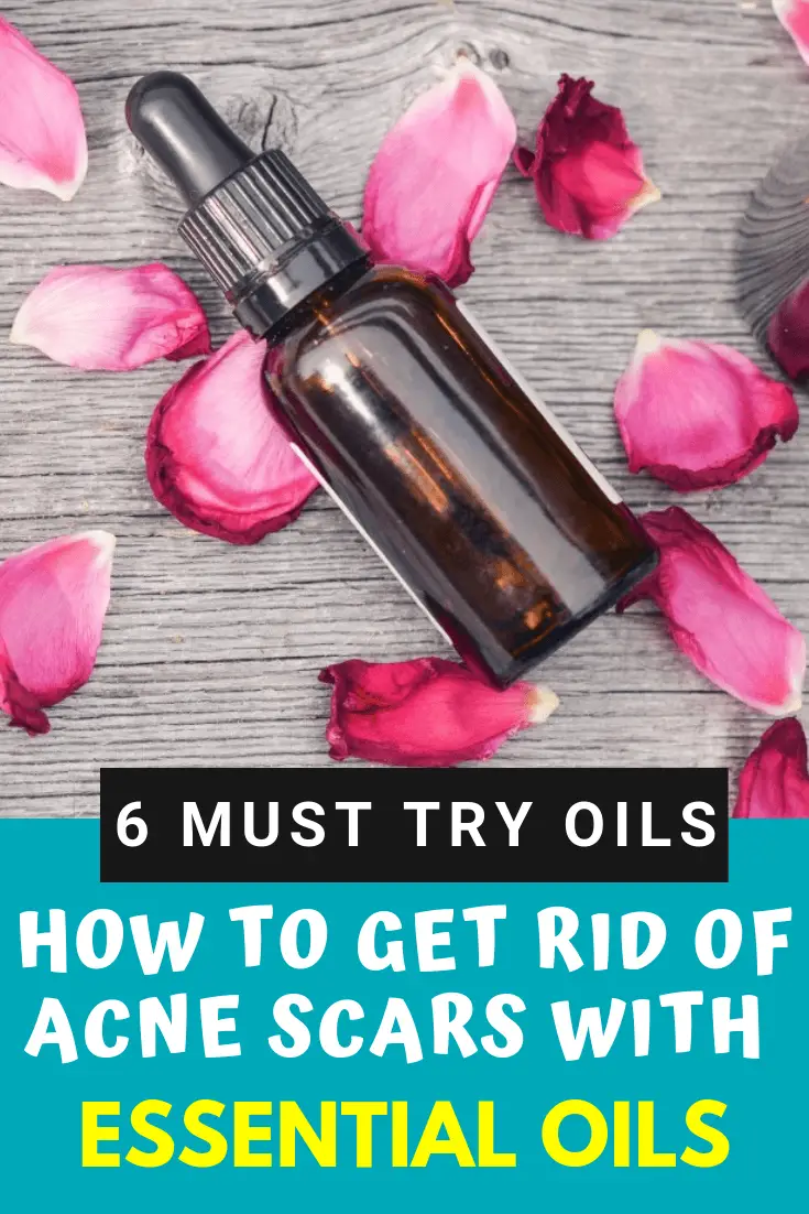 essential oils for acne scars pin