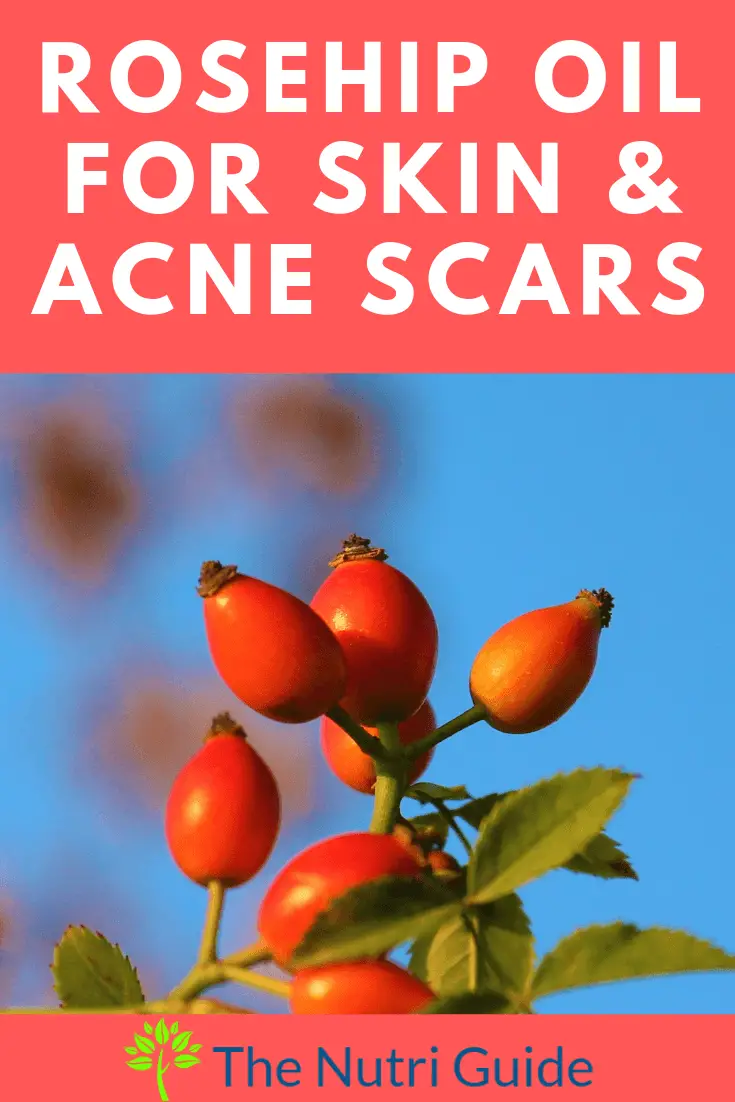 Rosehip Oil for Face & Acne Scars