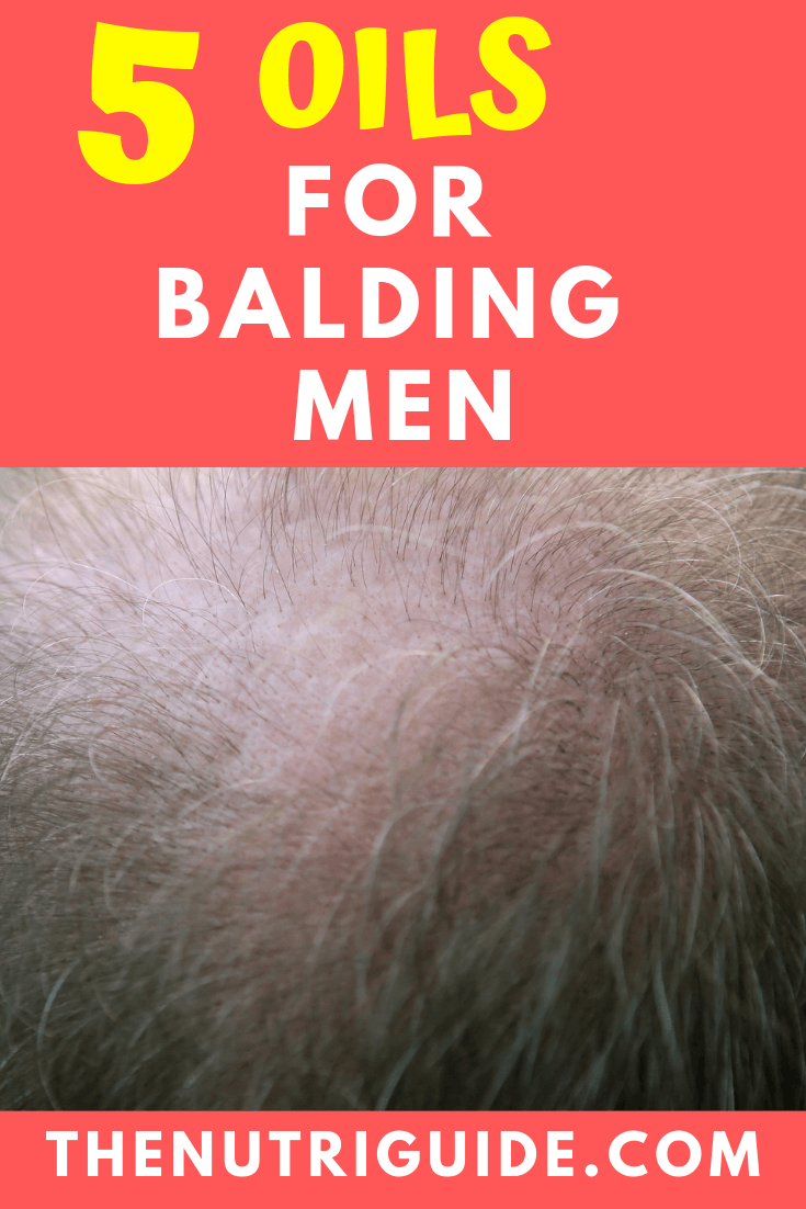 essential oils for balding men