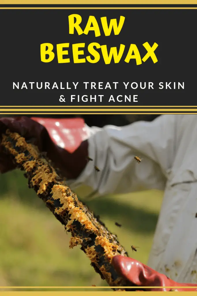 raw beeswax for acne and skin care