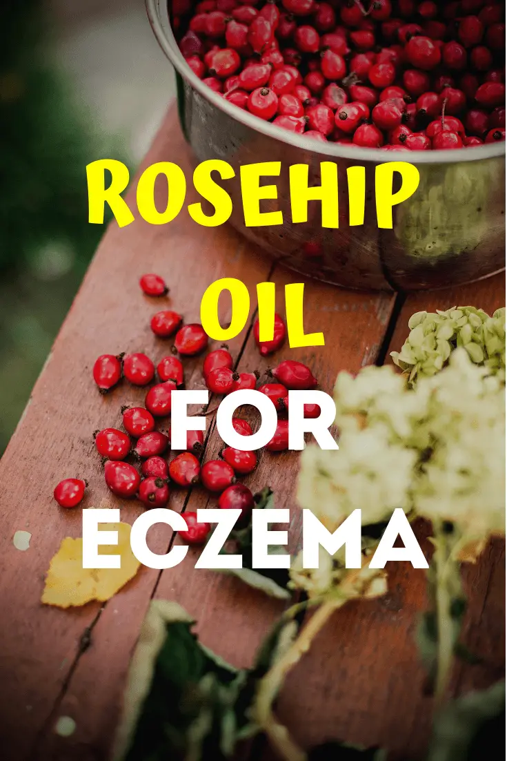 Rosehip Oil for Eczema 2
