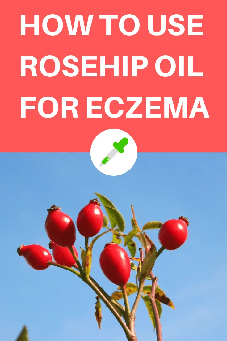 rosehip oil for eczema