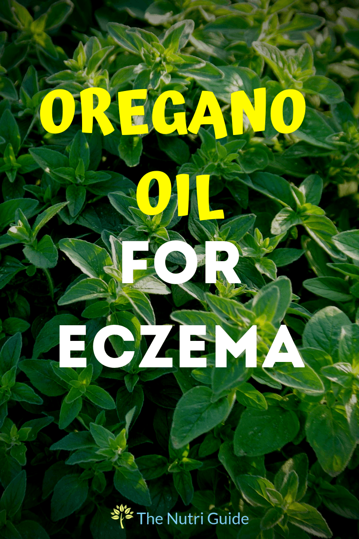 oregano oil for eczema