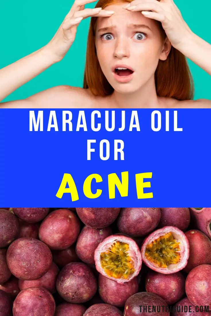 Maracuja Oil for Acne