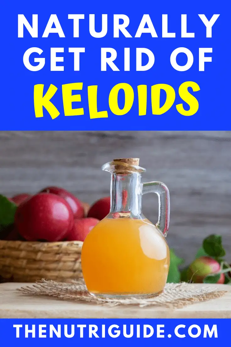 naturally get rid of keloids