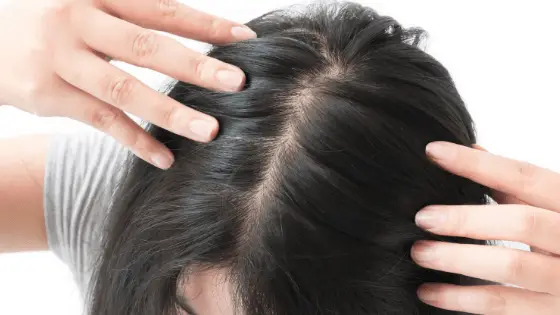 clove oil for hair growth