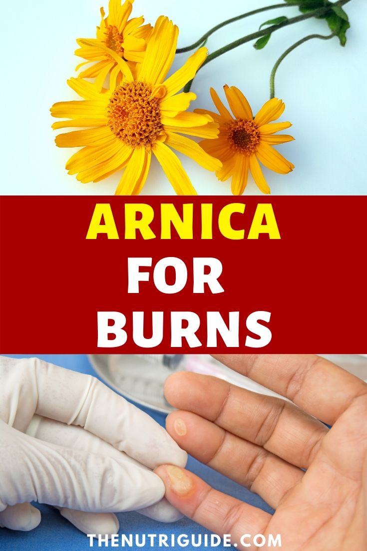 arinca for burns